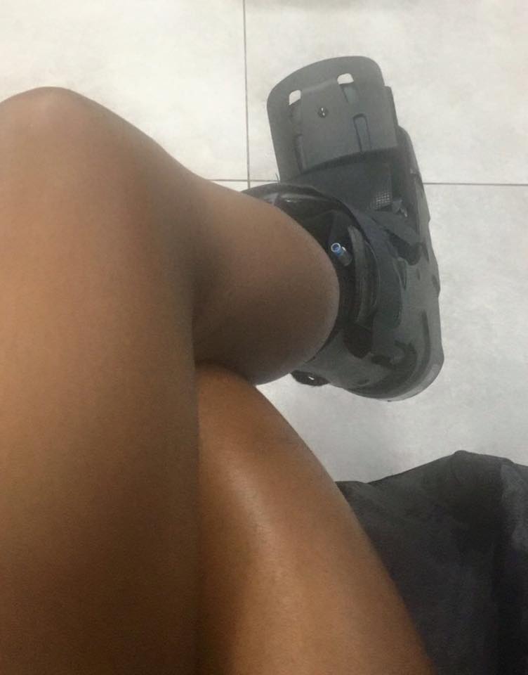 Fraser-Pryce wearing protective boot